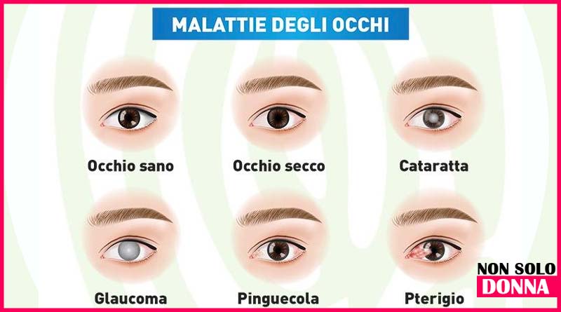 occhi