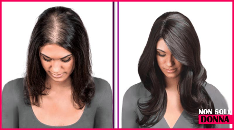ricrescita dei capelli